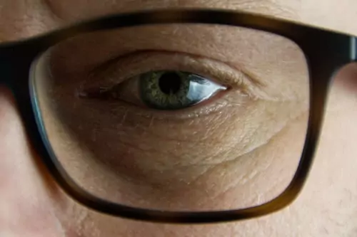 Stress Can Cause Problems For Your Eyes
